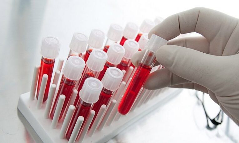 blood in tubes for analysis of a dog with prostatitis